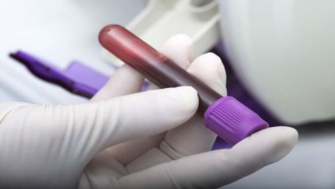 Cours de formation en ligne Sécurité en matière d'agents pathogènes transmissibles par le sang
